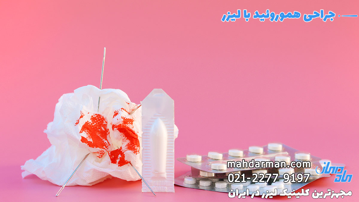 درمان خانگی هموروئید